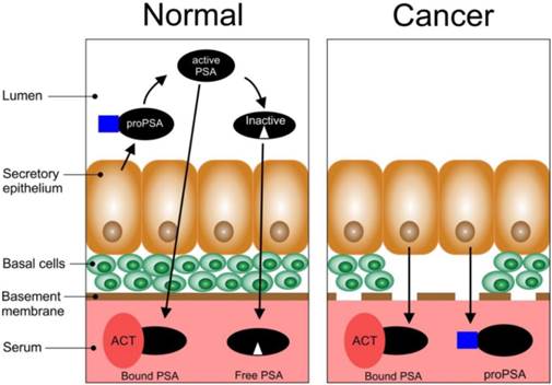 Image result for Device developed by Irish scientists to ‘vastly improve’ detection of prostate cancer