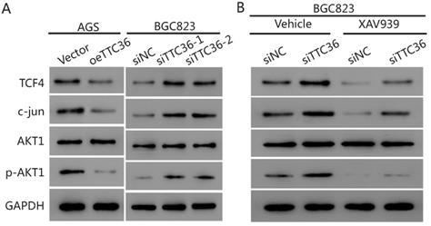 TTC36 inactivation induce malignant properties via Wnt-β 