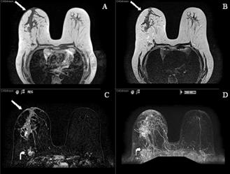 J Cancer Image