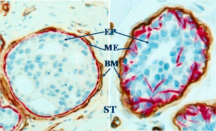 J Cancer Image