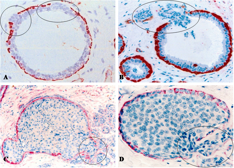 J Cancer Image