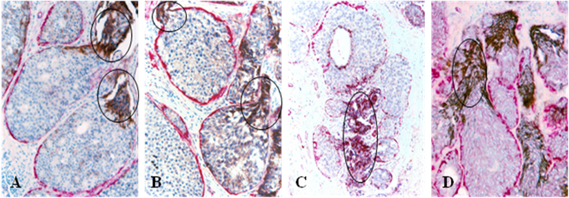 J Cancer Image