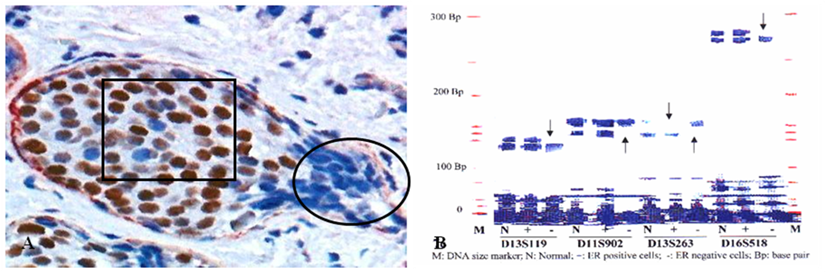 J Cancer Image