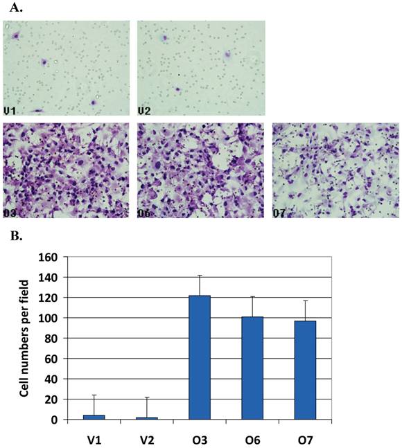 J Cancer Image