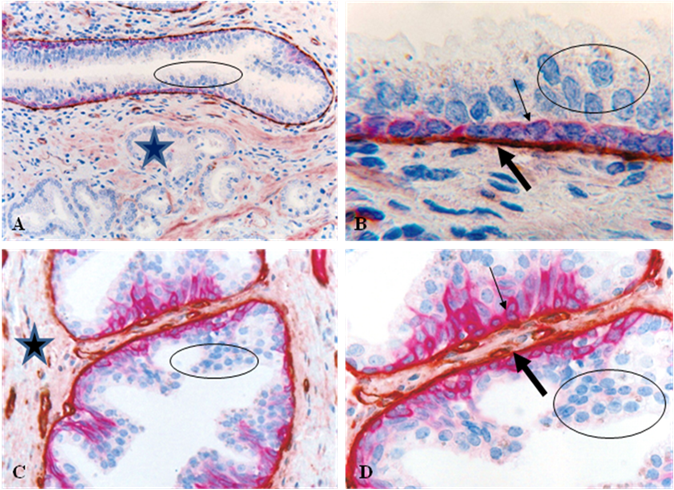 J Cancer Image