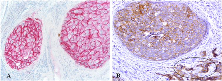 J Cancer Image