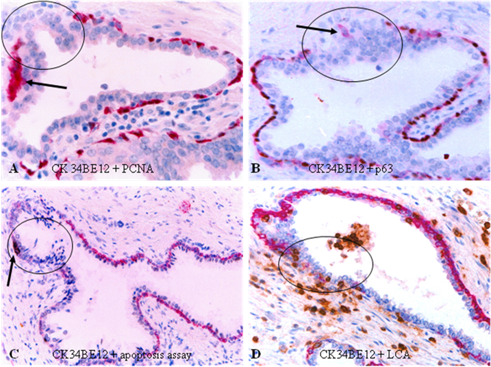 J Cancer Image