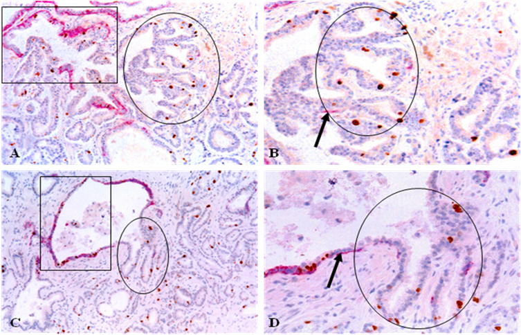 J Cancer Image