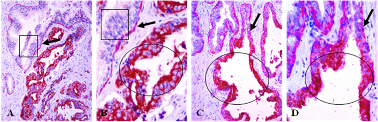 J Cancer Image