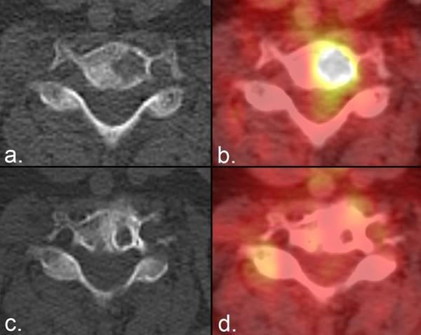 J Cancer Image