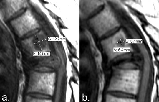 J Cancer Image