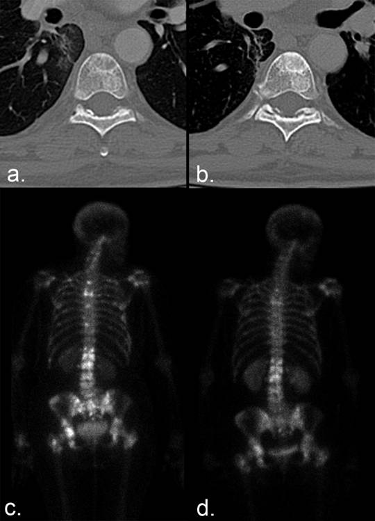 J Cancer Image