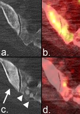 J Cancer Image