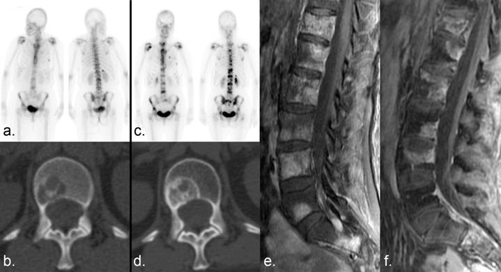 J Cancer Image