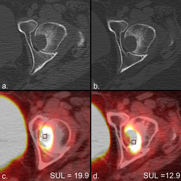 J Cancer Image