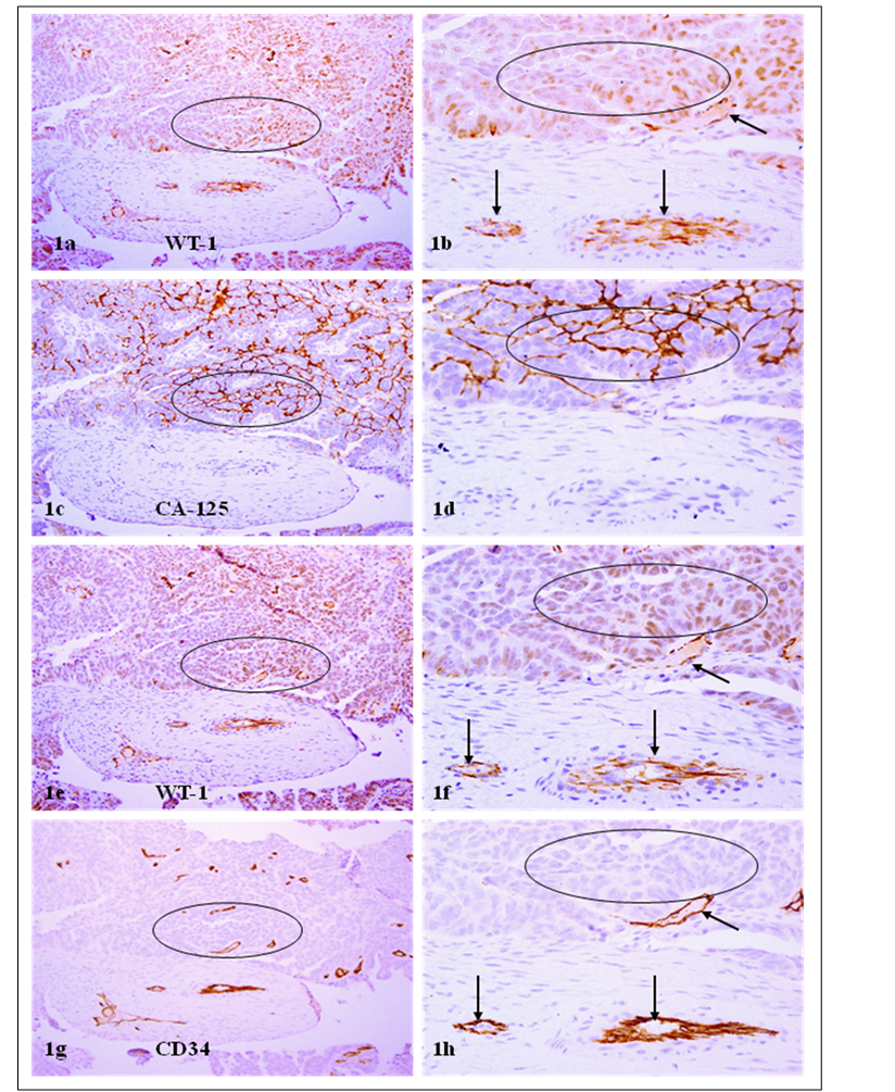 J Cancer Image