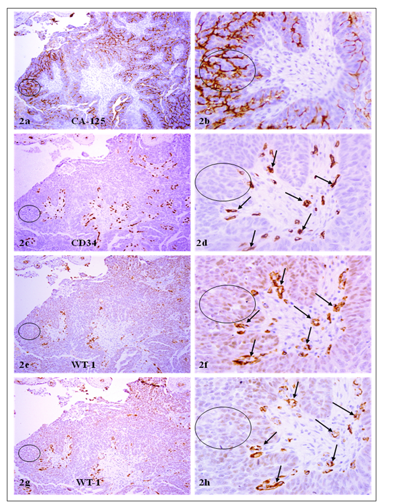 J Cancer Image