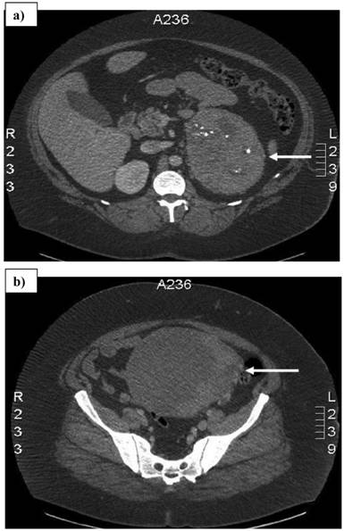 J Cancer Image