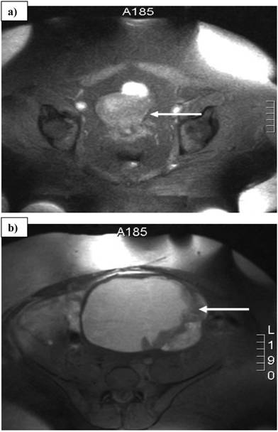 J Cancer Image