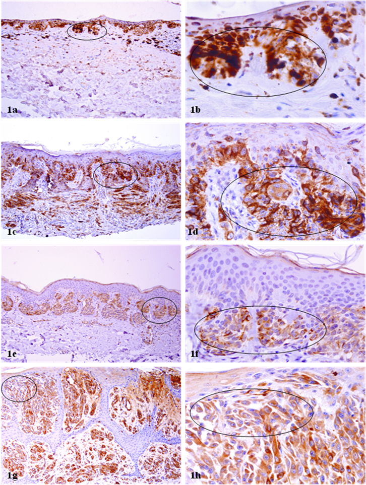 J Cancer Image