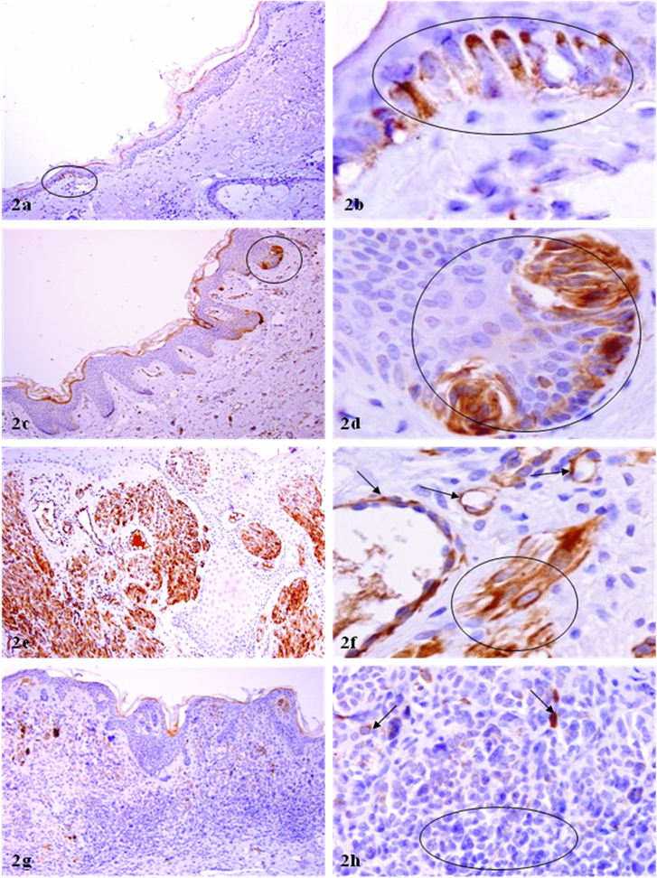 J Cancer Image