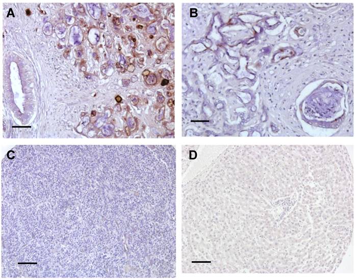 J Cancer Image