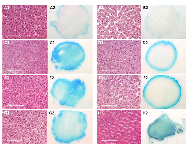 J Cancer Image