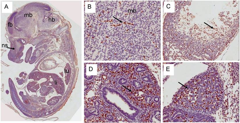 J Cancer Image