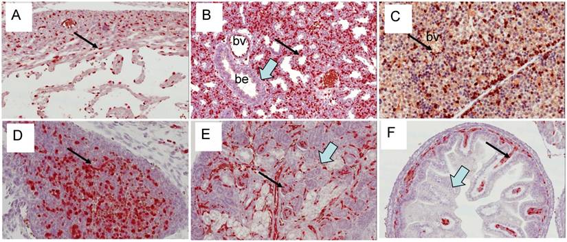 J Cancer Image