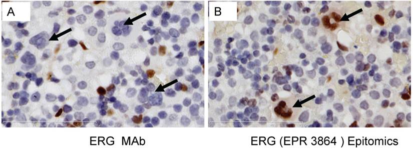 J Cancer Image