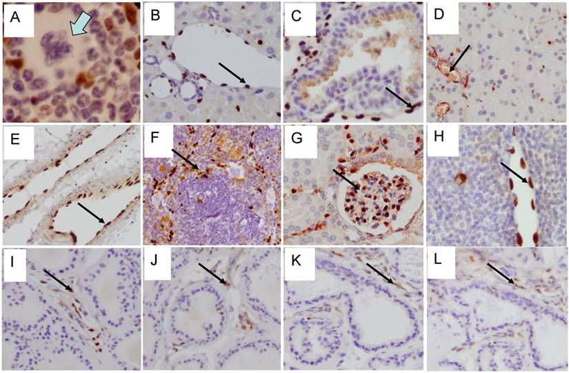 J Cancer Image