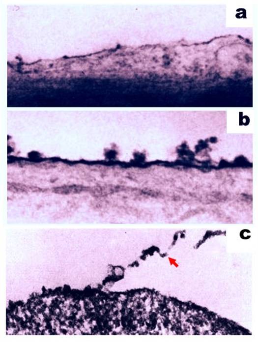 J Cancer Image