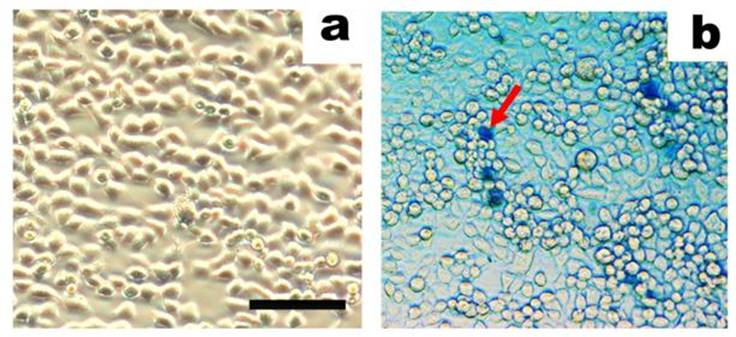 J Cancer Image