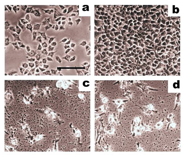 J Cancer Image