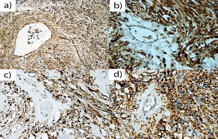 J Cancer Image