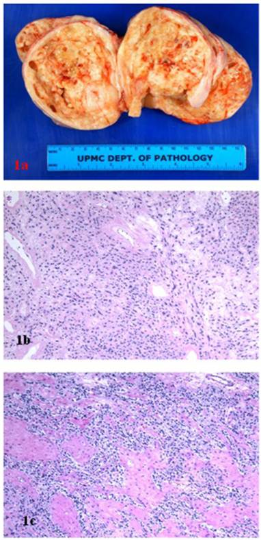 J Cancer Image