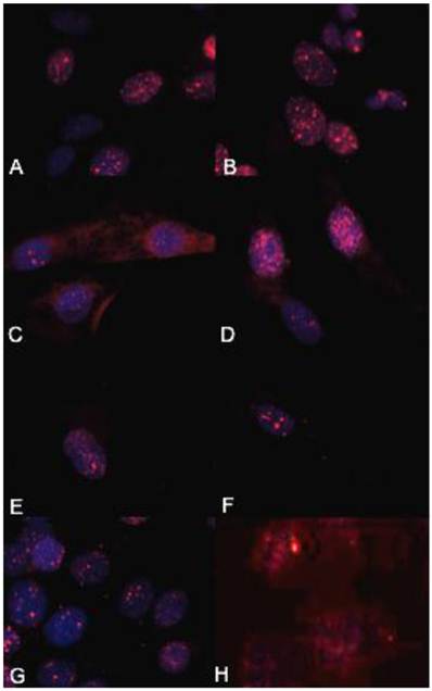 J Cancer Image