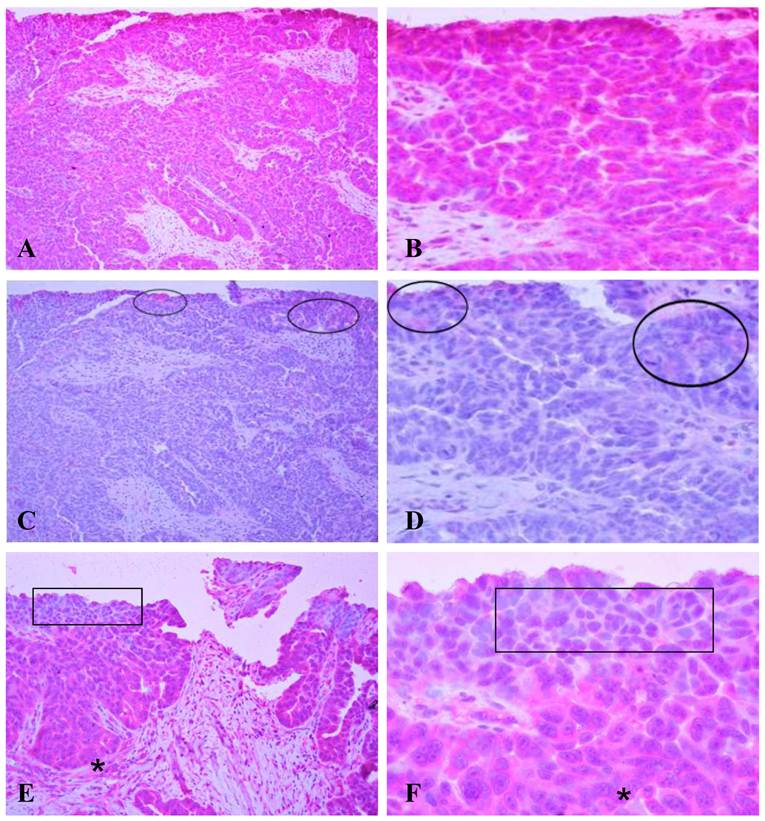 J Cancer Image