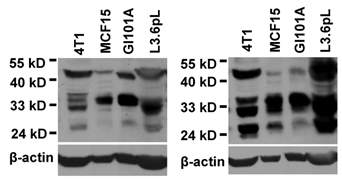 J Cancer Image