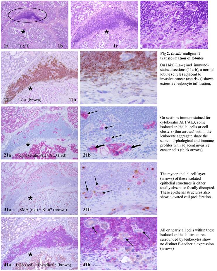 J Cancer Image