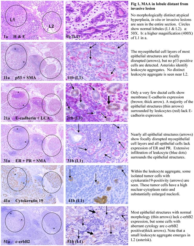 J Cancer Image