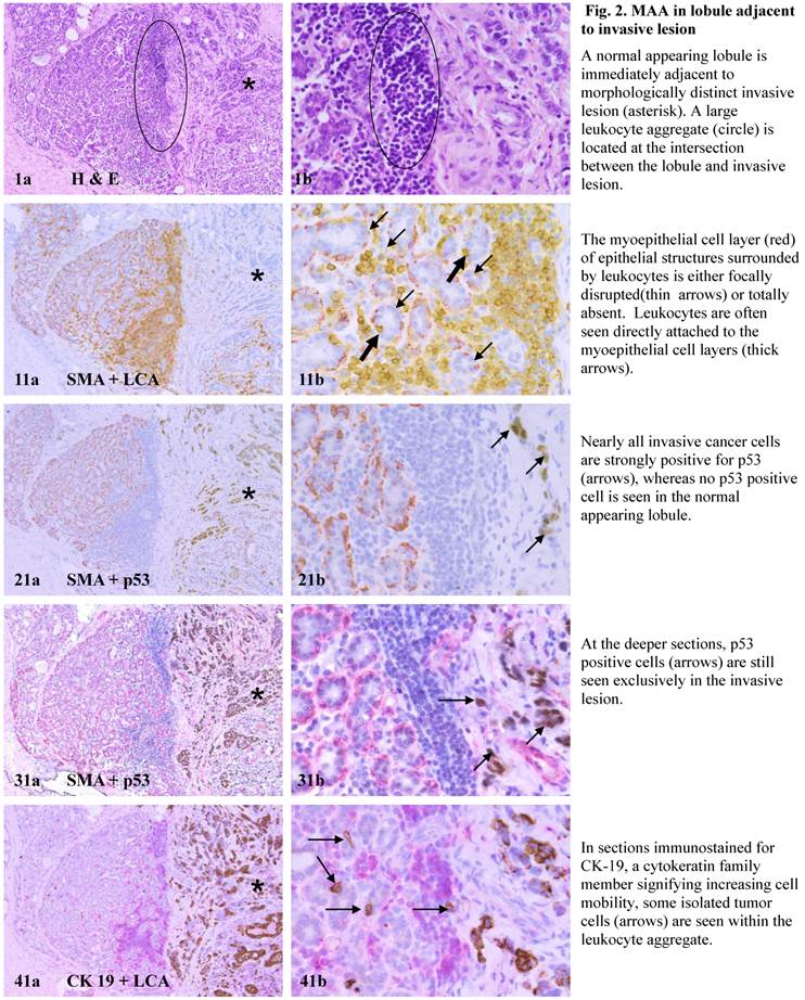 J Cancer Image