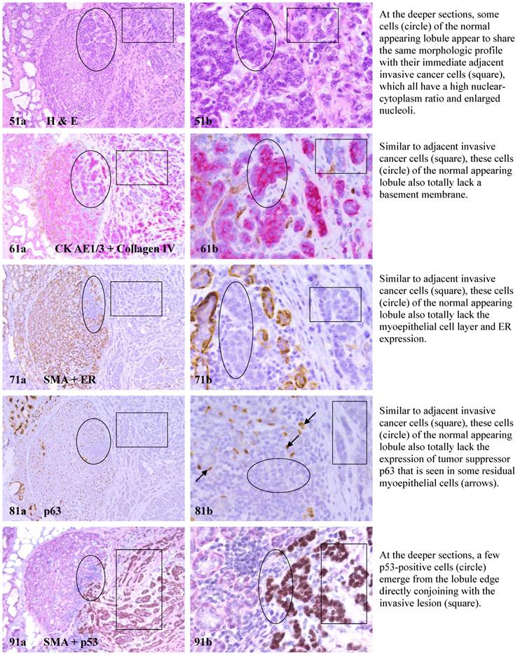 J Cancer Image