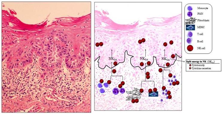 J Cancer Image