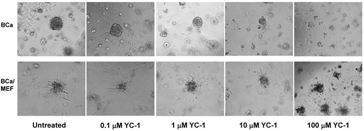 J Cancer Image