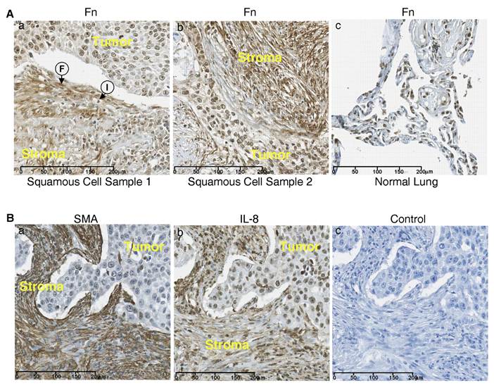 J Cancer Image