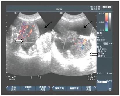 J Cancer Image