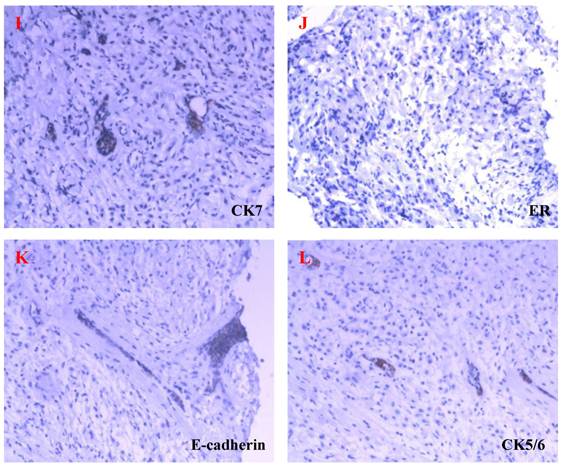 J Cancer Image