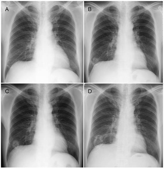 J Cancer Image