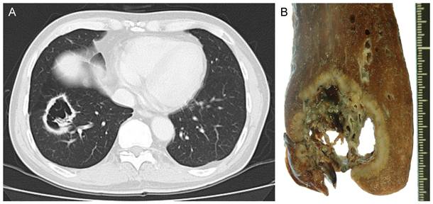 J Cancer Image